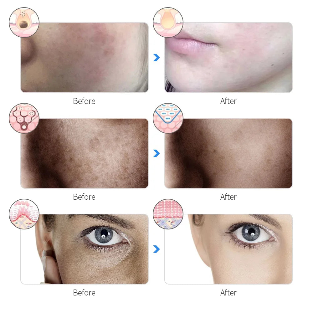 Rechargeable LED Facial Mask 7 Colors for Skin Care